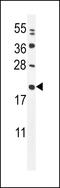 Coiled-Coil-Helix-Coiled-Coil-Helix Domain Containing 4 antibody, 55-895, ProSci, Western Blot image 