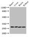 Serine Protease 2 antibody, CSB-PA018814LA01HU, Cusabio, Western Blot image 