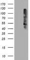 Transmembrane Protein With EGF Like And Two Follistatin Like Domains 2 antibody, MA5-25910, Invitrogen Antibodies, Western Blot image 