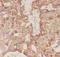 Follicle Stimulating Hormone Subunit Beta antibody, LS-C343969, Lifespan Biosciences, Immunohistochemistry paraffin image 