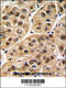 RNA Polymerase I And III Subunit C antibody, 61-539, ProSci, Immunohistochemistry paraffin image 
