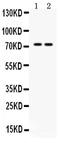 Protein Mdm4 antibody, PB9872, Boster Biological Technology, Western Blot image 