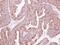 Kelch Like Family Member 2 antibody, GTX115614, GeneTex, Immunohistochemistry paraffin image 