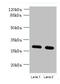 Transmembrane Protein 38B antibody, CSB-PA878900LA01HU, Cusabio, Western Blot image 