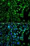Mitogen-activated protein kinase kinase kinase MLT antibody, LS-C349093, Lifespan Biosciences, Immunofluorescence image 