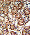 Guanine Monophosphate Synthase antibody, LS-C166539, Lifespan Biosciences, Immunohistochemistry paraffin image 