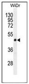 Gsdmc1 antibody, AP51961PU-N, Origene, Western Blot image 