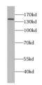 Proteasome Activator Subunit 4 antibody, FNab06897, FineTest, Western Blot image 