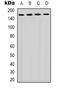 Phospholipase C Gamma 1 antibody, orb338934, Biorbyt, Western Blot image 