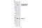 ALK Receptor Tyrosine Kinase antibody, 3983T, Cell Signaling Technology, Western Blot image 