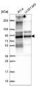 Transforming Acidic Coiled-Coil Containing Protein 2 antibody, NBP2-57227, Novus Biologicals, Western Blot image 