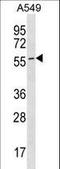 Endothelial Cell Adhesion Molecule antibody, LS-C159569, Lifespan Biosciences, Western Blot image 