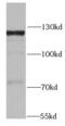 Mtr4 Exosome RNA Helicase antibody, FNab07896, FineTest, Western Blot image 