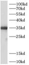 Myeloid differentiation primary response protein MyD88 antibody, FNab10265, FineTest, Western Blot image 