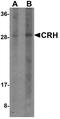 Corticotropin Releasing Hormone antibody, A00629, Boster Biological Technology, Western Blot image 