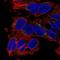Solute Carrier Family 29 Member 3 antibody, HPA046085, Atlas Antibodies, Immunocytochemistry image 