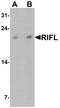 Angiopoietin Like 8 antibody, A02471-1, Boster Biological Technology, Western Blot image 