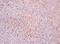 pMKP1 antibody, orb2984, Biorbyt, Immunohistochemistry paraffin image 