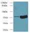 Armadillo Repeat Containing 10 antibody, A58146-100, Epigentek, Western Blot image 