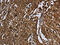Rho GDP Dissociation Inhibitor Alpha antibody, CSB-PA192321, Cusabio, Immunohistochemistry paraffin image 
