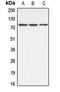 ATP Binding Cassette Subfamily B Member 10 antibody, orb215083, Biorbyt, Western Blot image 