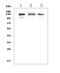 Growth Hormone Receptor antibody, A00698-1, Boster Biological Technology, Western Blot image 