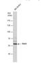 P21 (RAC1) Activated Kinase 1 antibody, NBP2-19680, Novus Biologicals, Western Blot image 