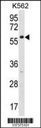 Zinc Finger Protein 212 antibody, 60-033, ProSci, Western Blot image 