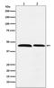 Flap Structure-Specific Endonuclease 1 antibody, M01484-2, Boster Biological Technology, Western Blot image 