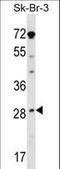 Steroidogenic Acute Regulatory Protein antibody, LS-C161542, Lifespan Biosciences, Western Blot image 