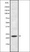 RAN Binding Protein 1 antibody, orb337230, Biorbyt, Western Blot image 
