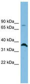 Solute Carrier Family 6 Member 15 antibody, TA334628, Origene, Western Blot image 