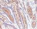 Carcinoembryonic Antigen Related Cell Adhesion Molecule 5 antibody, V7069IHC-7ML, NSJ Bioreagents, Immunohistochemistry paraffin image 
