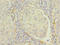 RAP1B, Member Of RAS Oncogene Family antibody, A60522-100, Epigentek, Immunohistochemistry paraffin image 