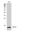 Heat Shock Protein Family E (Hsp10) Member 1 antibody, STJ93613, St John