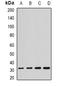 SCO Cytochrome C Oxidase Assembly Protein 2 antibody, orb382026, Biorbyt, Western Blot image 