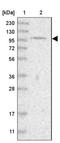 Fibroblast Growth Factor Receptor 4 antibody, NBP1-84585, Novus Biologicals, Western Blot image 