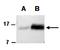 Fms Related Tyrosine Kinase 3 Ligand antibody, orb66818, Biorbyt, Western Blot image 