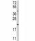 Autophagy Related 12 antibody, F41508-0.4ML, NSJ Bioreagents, Western Blot image 