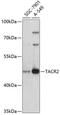 Substance-K receptor antibody, 18-947, ProSci, Western Blot image 