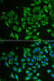 C-Type Lectin Domain Family 3 Member B antibody, STJ28501, St John