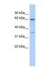 Zinc Finger Protein 648 antibody, NBP1-79353, Novus Biologicals, Western Blot image 