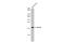 Eukaryotic Translation Initiation Factor 5A antibody, GTX111013, GeneTex, Western Blot image 