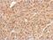 Glycogen Phosphorylase B antibody, NBP1-32799, Novus Biologicals, Immunohistochemistry paraffin image 