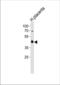 Peroxisome Proliferator Activated Receptor Delta antibody, TA324526, Origene, Western Blot image 