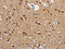 Interleukin 19 antibody, CSB-PA021391, Cusabio, Immunohistochemistry paraffin image 