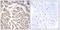 Bromodomain And WD Repeat Domain Containing 3 antibody, A08515, Boster Biological Technology, Immunohistochemistry paraffin image 