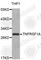 TNF Receptor Superfamily Member 1A antibody, A1540, ABclonal Technology, Western Blot image 