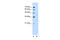 GNAS antibody, 29-640, ProSci, Western Blot image 