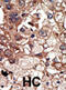 Epidermal Growth Factor Receptor Pathway Substrate 8 antibody, abx033909, Abbexa, Immunohistochemistry paraffin image 